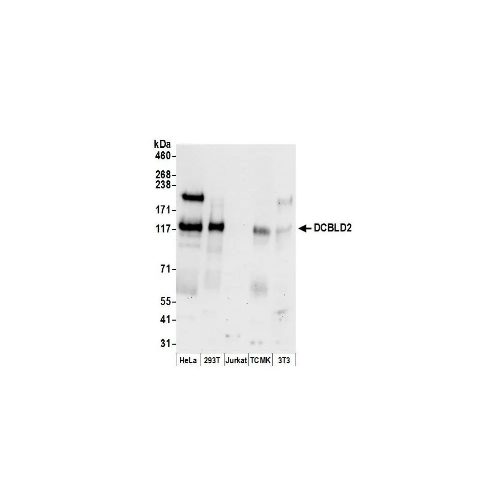 Rabbit anti-DCBLD2 Antibody, Affinity Purified