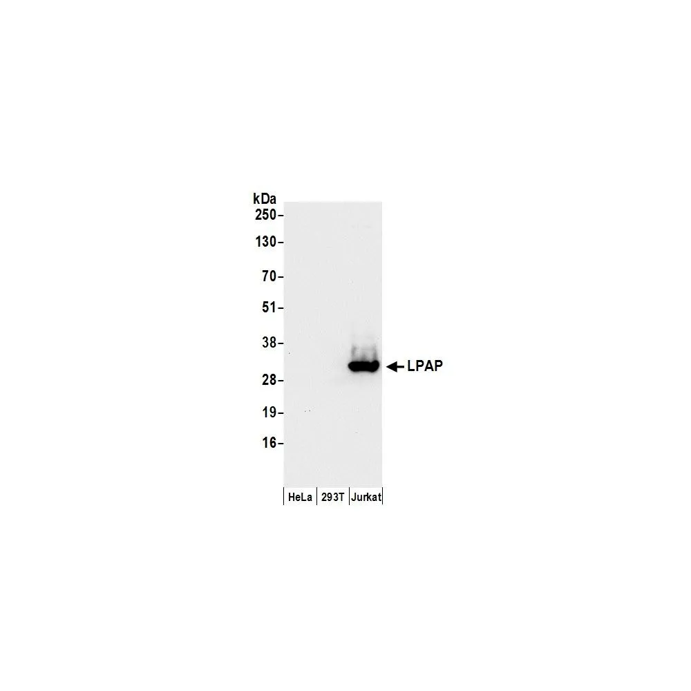 Rabbit anti-LPAP Antibody, Affinity Purified