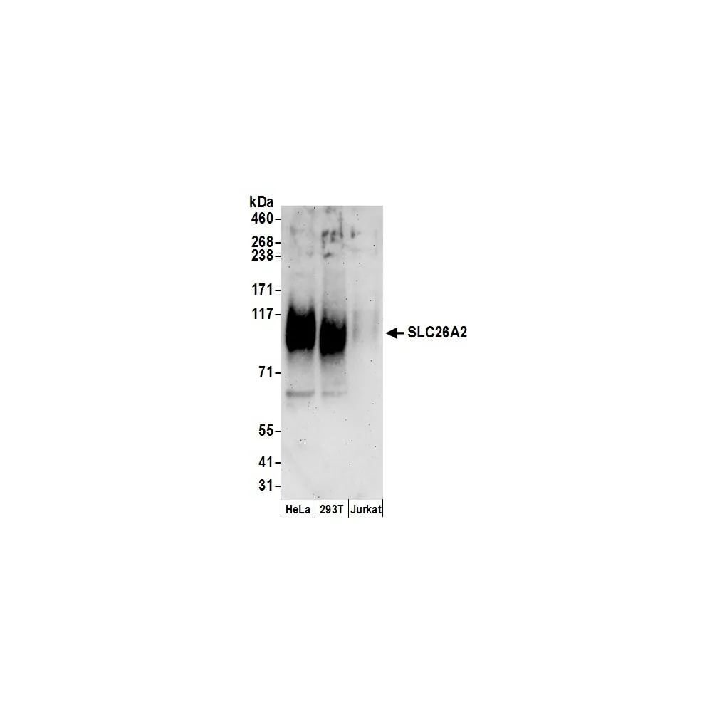 Rabbit anti-SLC26A2 Antibody, Affinity Purified