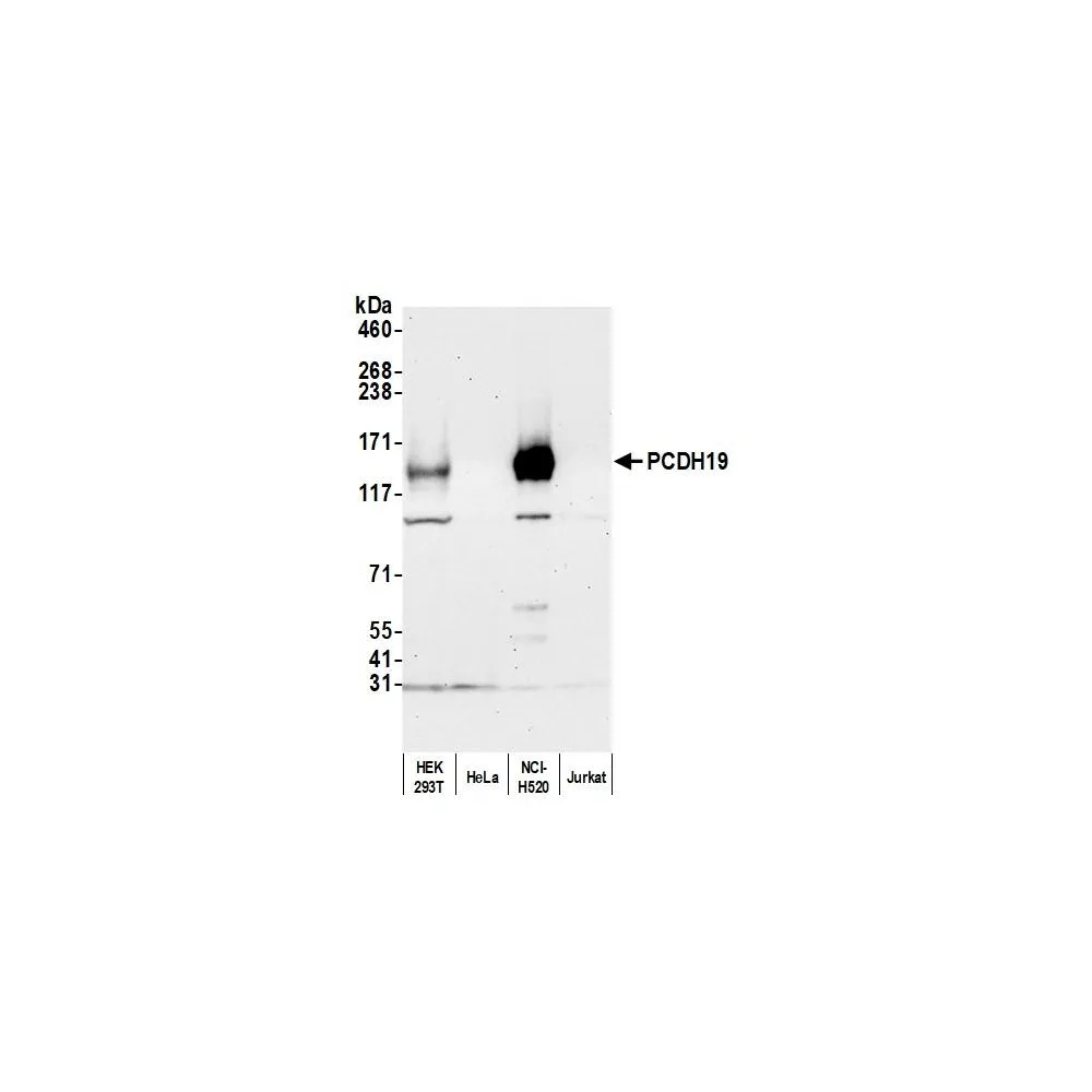 Rabbit anti-PCDH19 Antibody, Affinity Purified