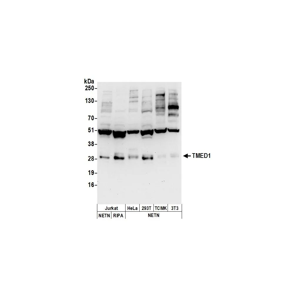 Rabbit anti-TMED1 Antibody, Affinity Purified