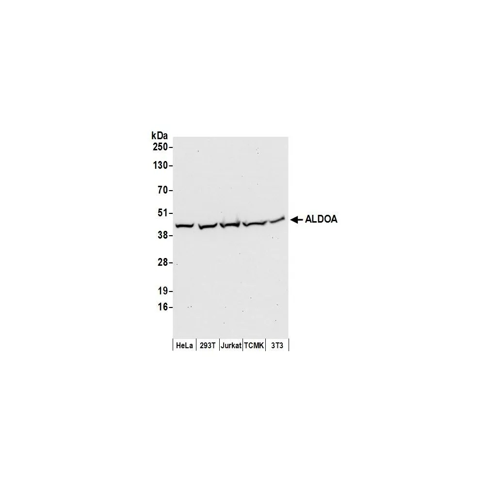 Rabbit anti-ALDOA Antibody, Affinity Purified
