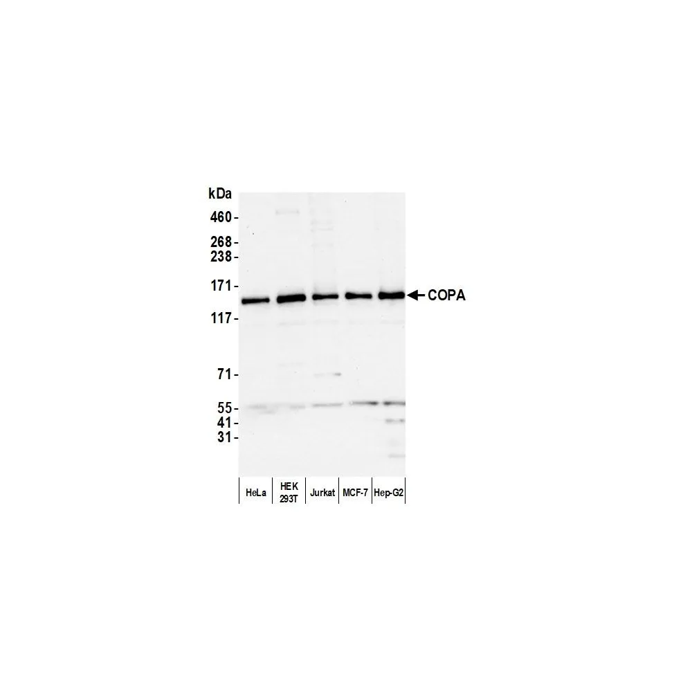 Rabbit anti-COPA Antibody, Affinity Purified