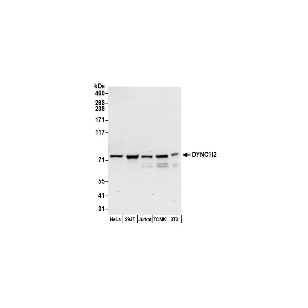 Rabbit anti-DYNC1I2 Antibody, Affinity Purified
