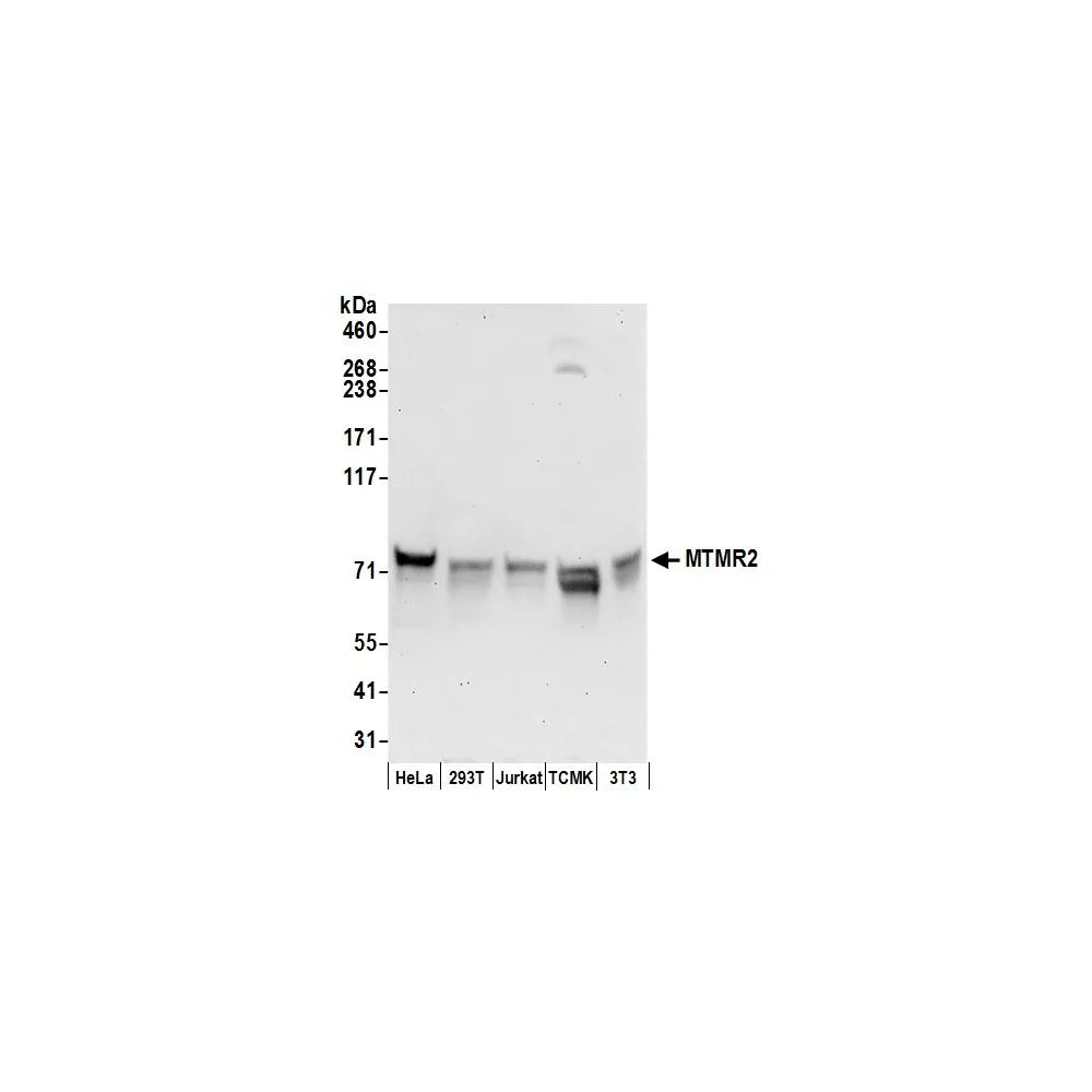 Rabbit anti-MTMR2 Antibody, Affinity Purified