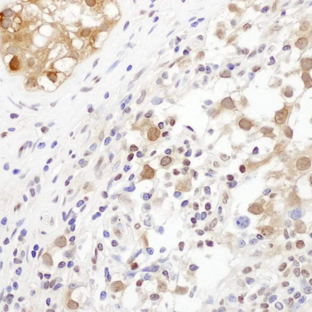 Rabbit anti-TRAX Antibody, Affinity Purified