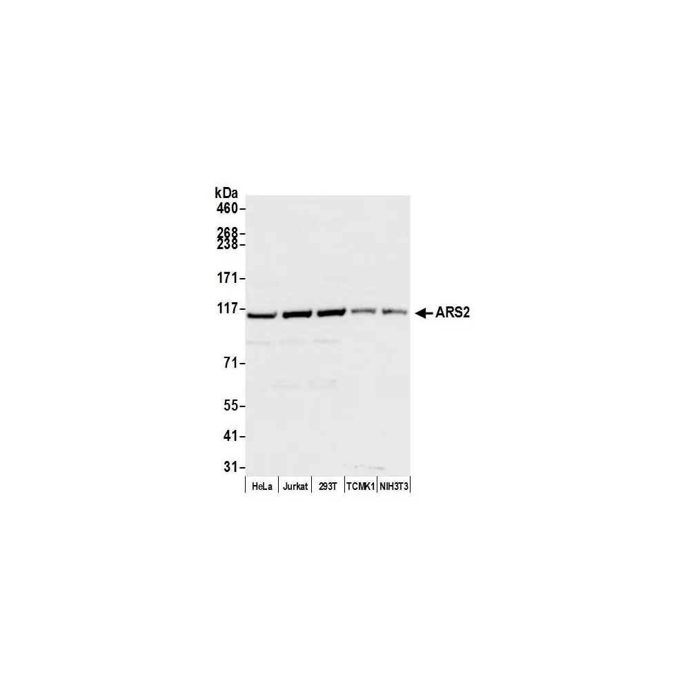 Rabbit anti-ARS2 Antibody, Affinity Purified