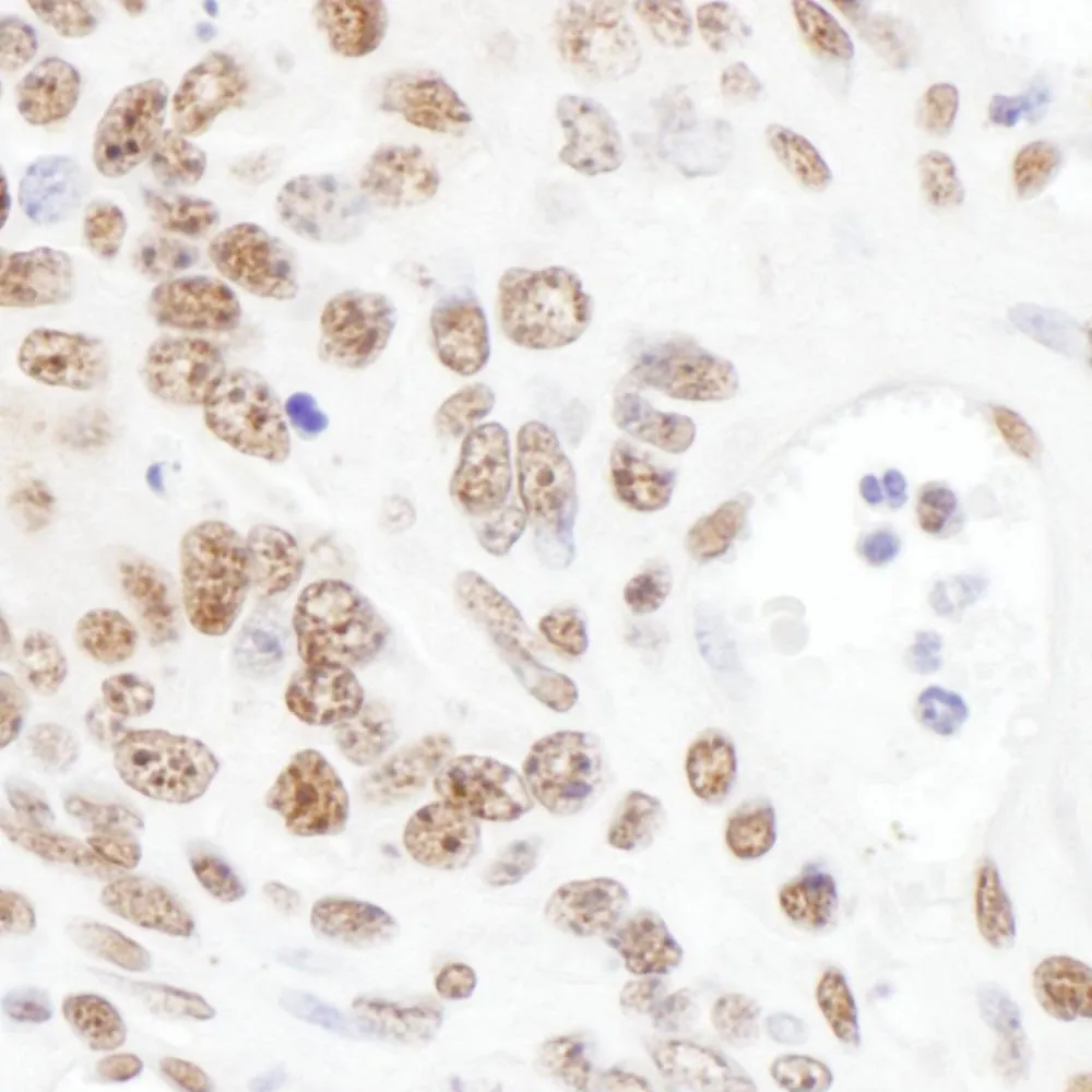 Rabbit anti-ARS2 Antibody, Affinity Purified