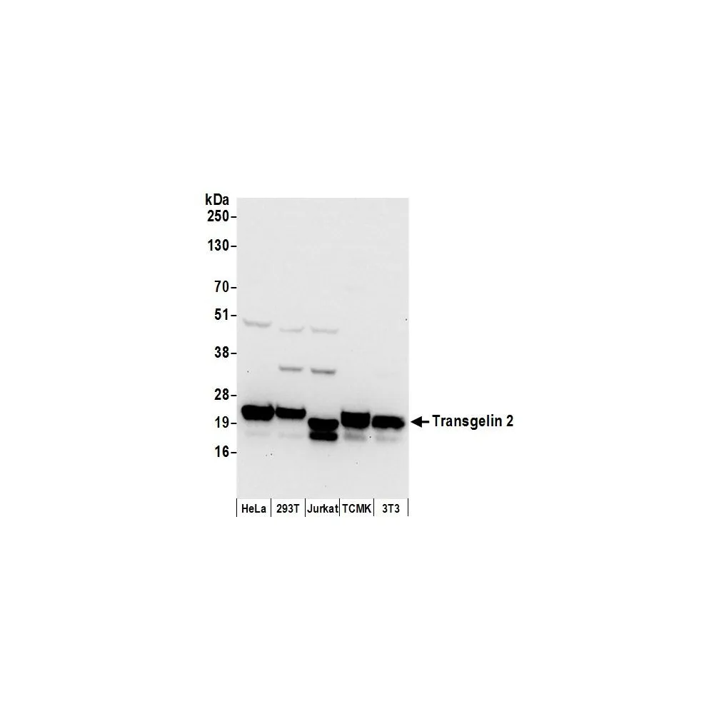 Rabbit anti-Transgelin 2 Antibody, Affinity Purified