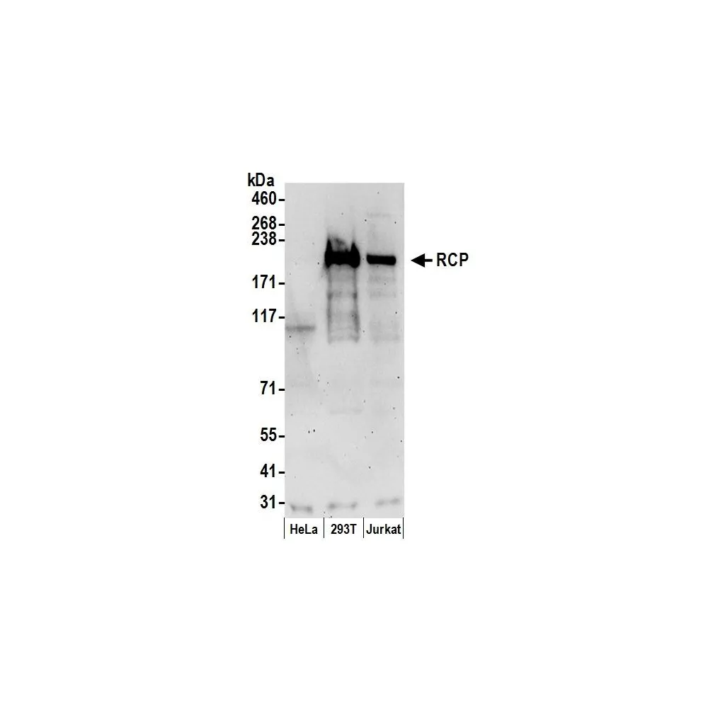 Rabbit anti-RCP Antibody, Affinity Purified