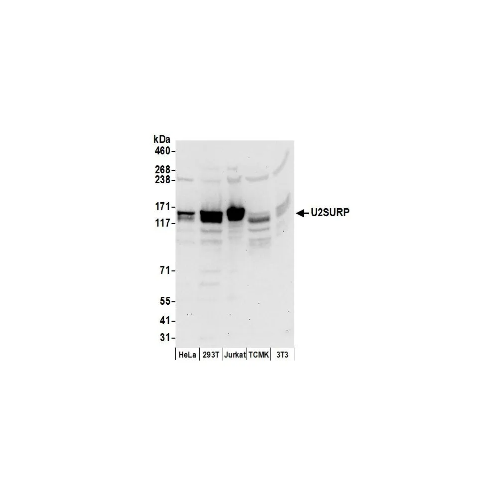 Rabbit anti-U2SURP Antibody, Affinity Purified