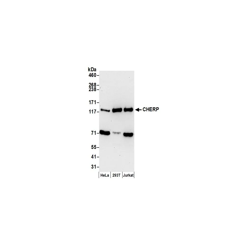 Rabbit anti-CHERP Antibody, Affinity Purified