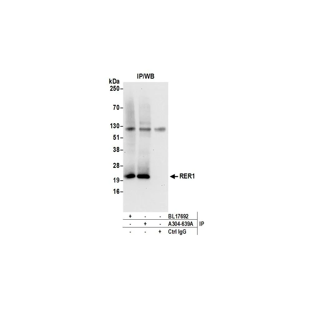 Rabbit anti-RER1 Antibody, Affinity Purified