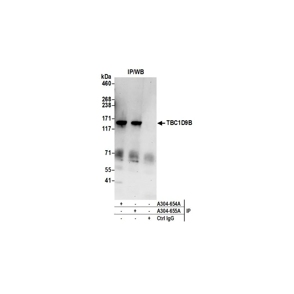 Rabbit anti-TBC1D9B Antibody, Affinity Purified