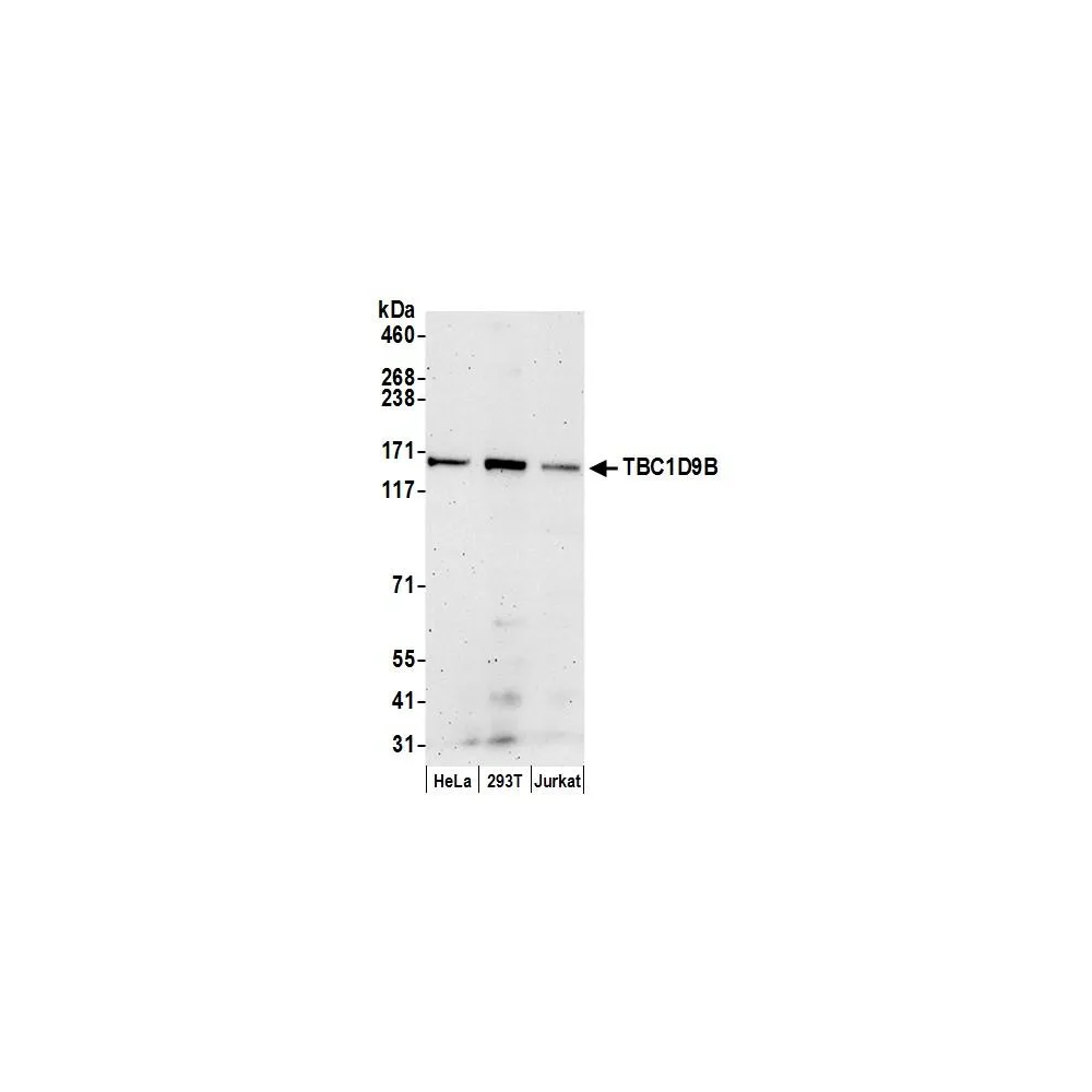 Rabbit anti-TBC1D9B Antibody, Affinity Purified