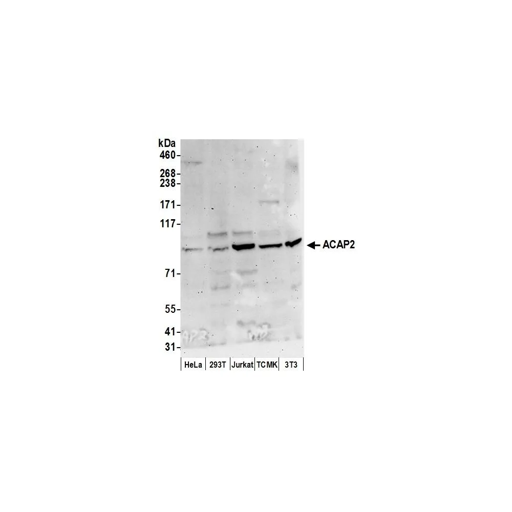 Rabbit anti-ACAP2 Antibody, Affinity Purified