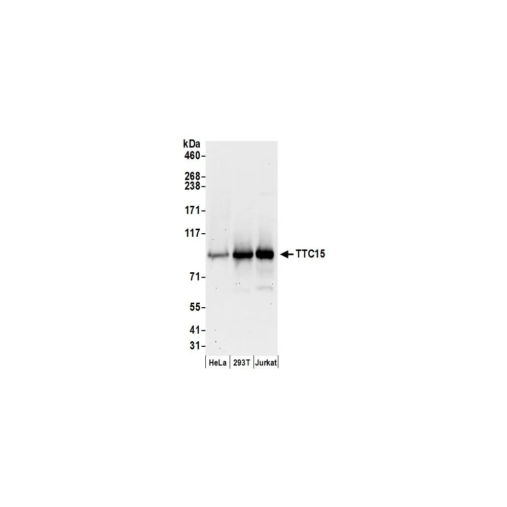 Rabbit anti-TTC15 Antibody, Affinity Purified
