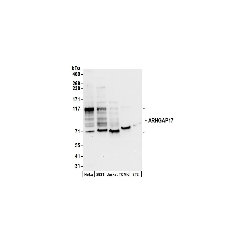 Rabbit anti-ARHGAP17 Antibody, Affinity Purified