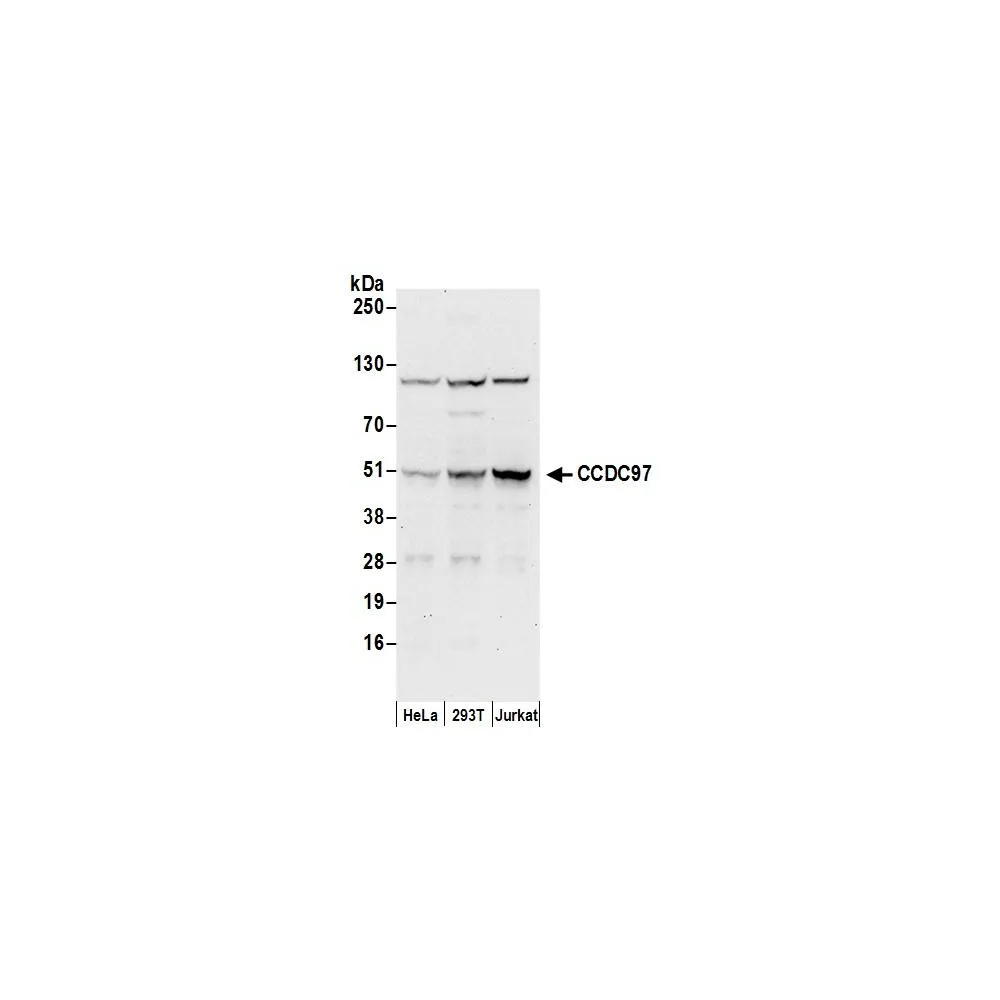 Rabbit anti-CCDC97 Antibody, Affinity Purified