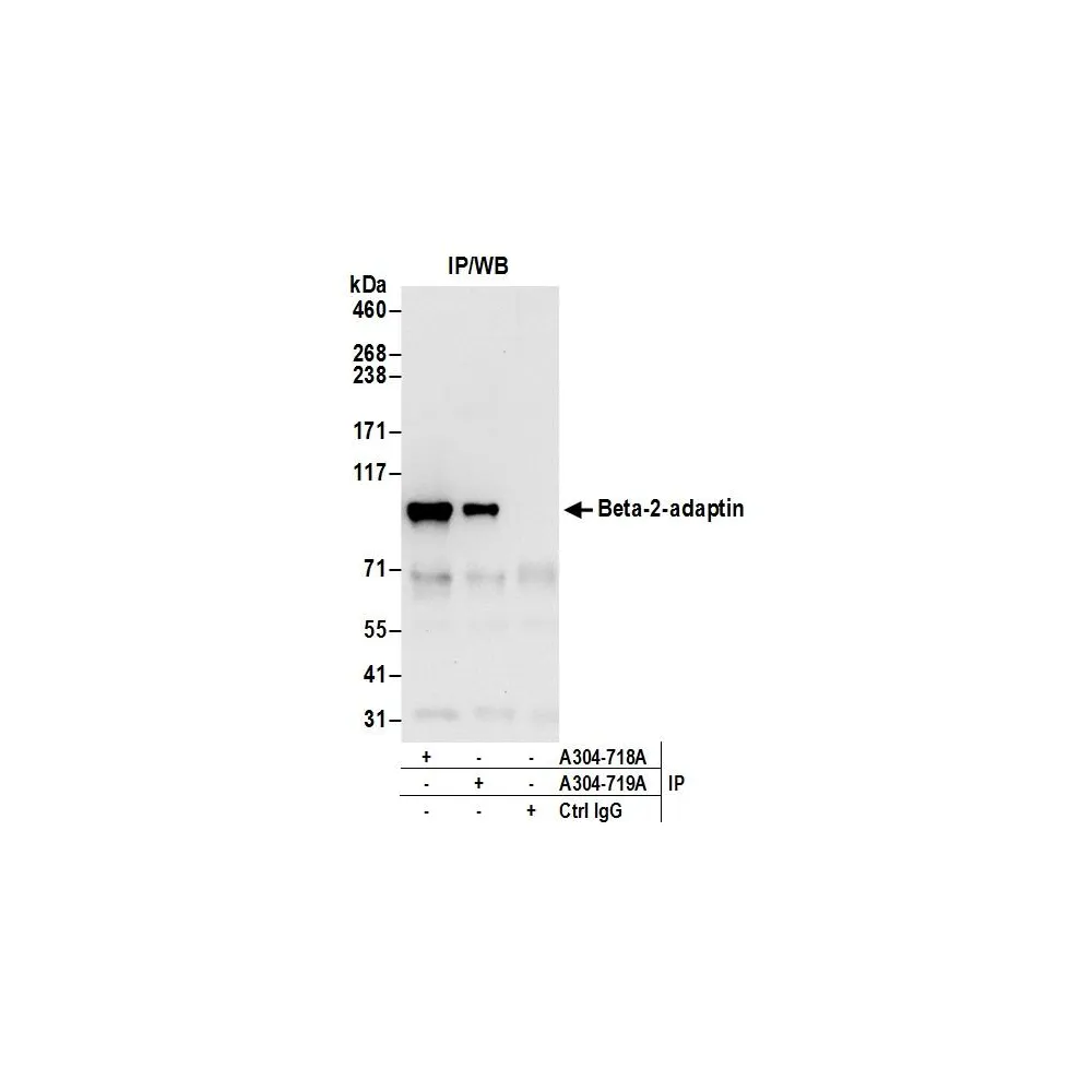 Rabbit anti-Beta-2-adaptin Antibody, Affinity Purified