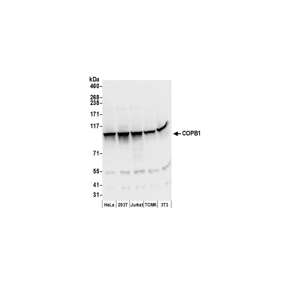 Rabbit anti-COPB1 Antibody, Affinity Purified