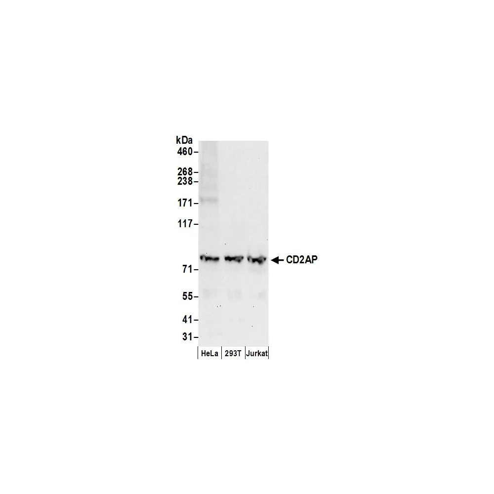 Rabbit anti-CD2AP Antibody, Affinity Purified