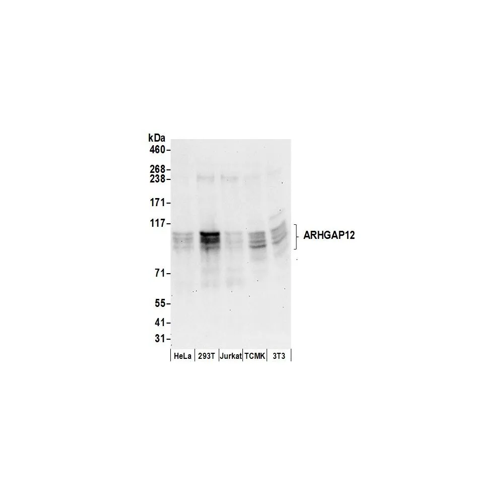 Rabbit anti-ARHGAP12 Antibody, Affinity Purified