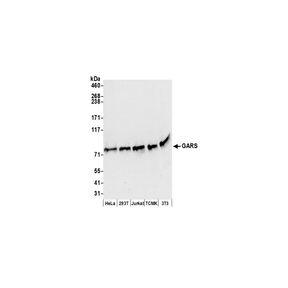 Rabbit anti-GARS Antibody, Affinity Purified
