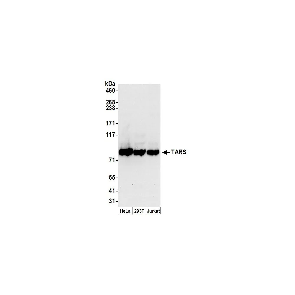 Rabbit anti-TARS Antibody, Affinity Purified