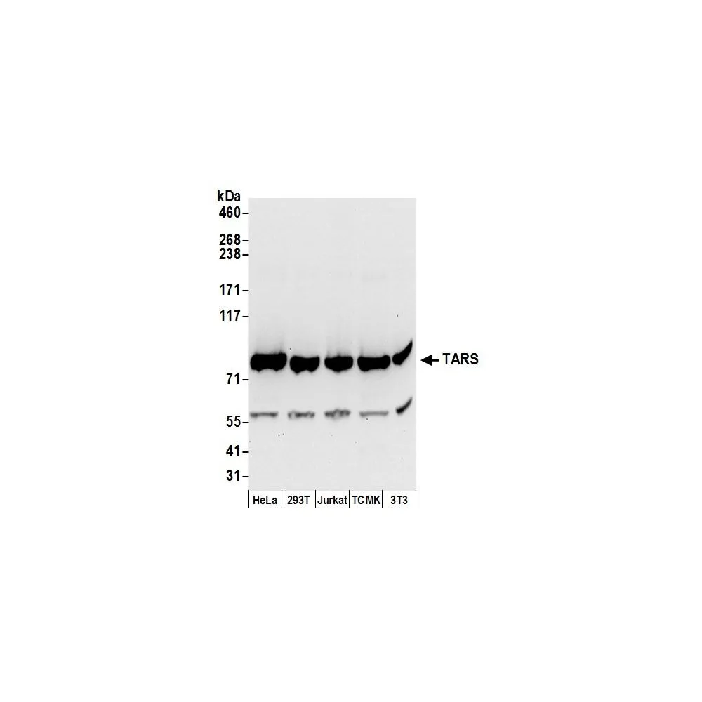 Rabbit anti-TARS Antibody, Affinity Purified
