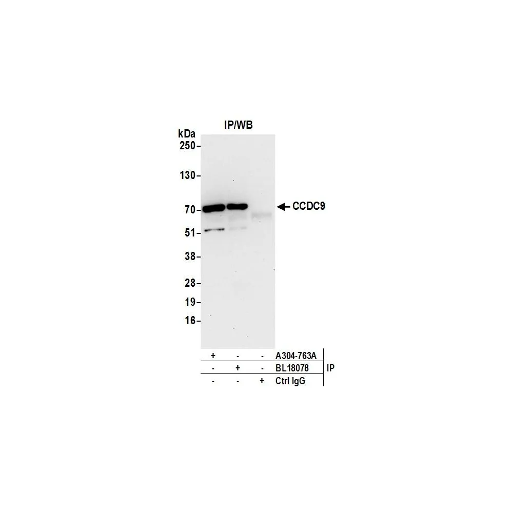 Rabbit anti-CCDC9 Antibody, Affinity Purified