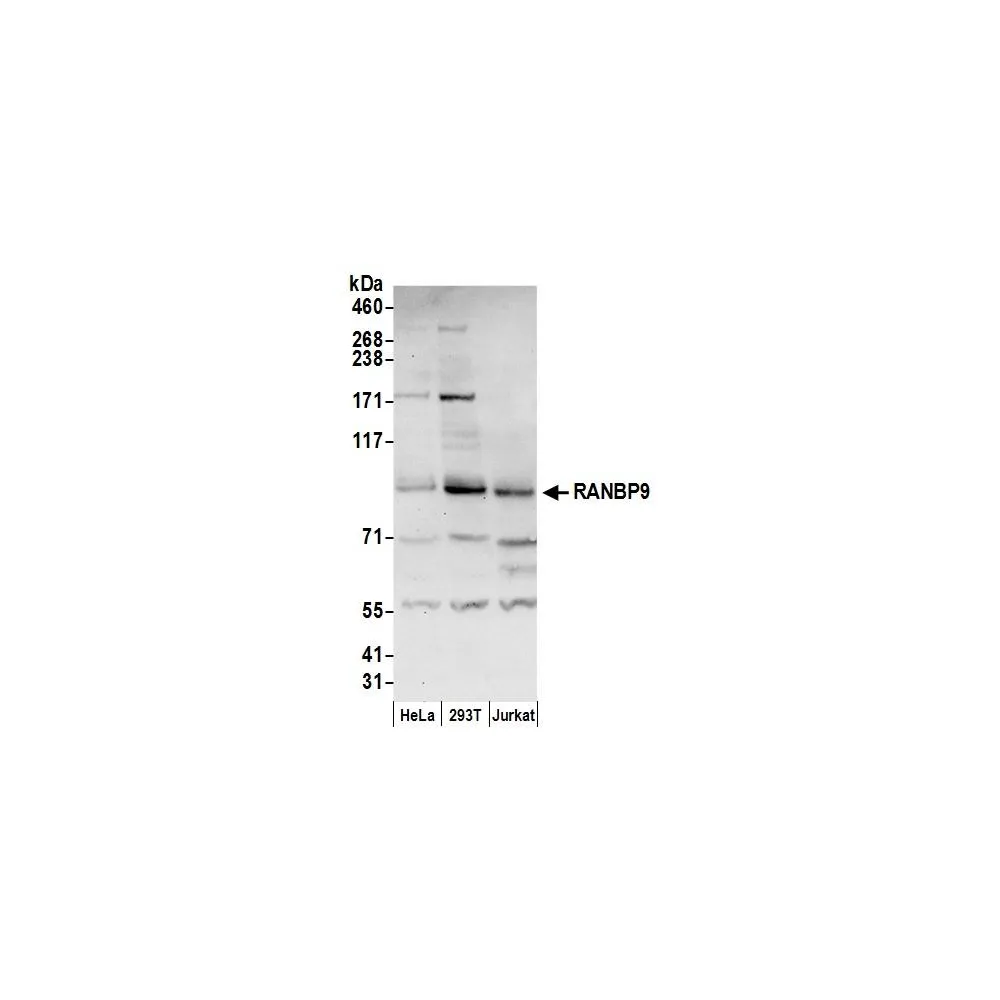 Rabbit anti-RANBP9 Antibody, Affinity Purified