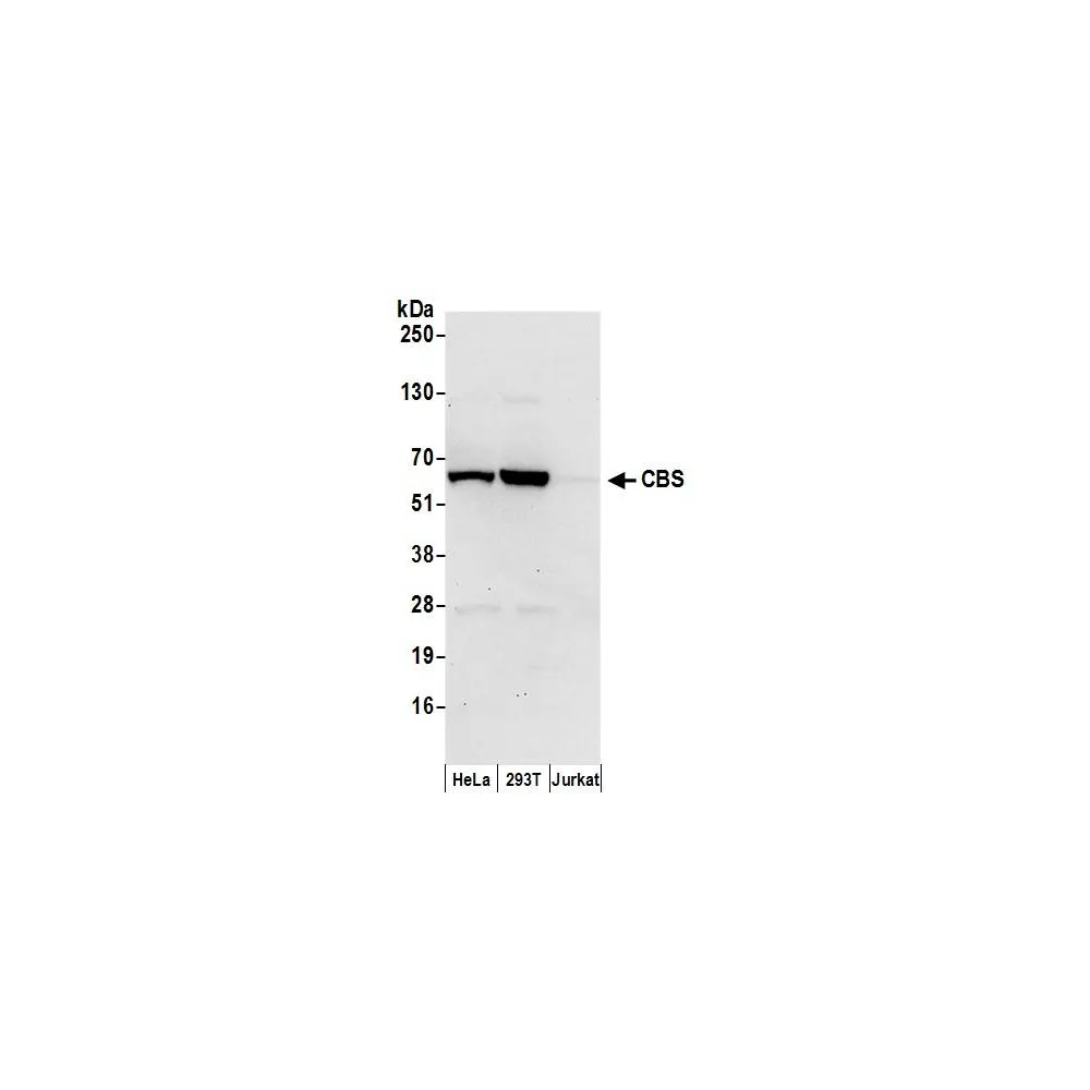 Rabbit anti-CBS Antibody, Affinity Purified