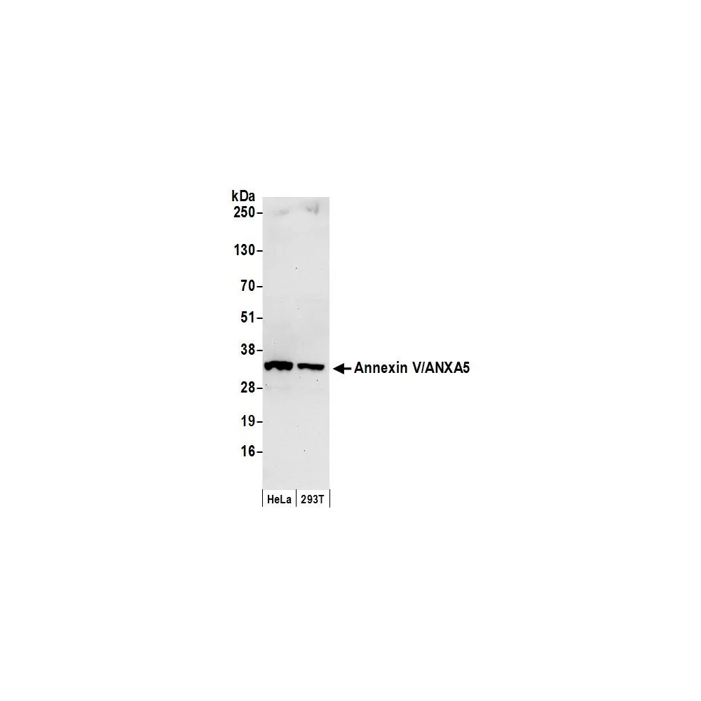 Rabbit anti-Annexin V/ANXA5 Antibody, Affinity Purified