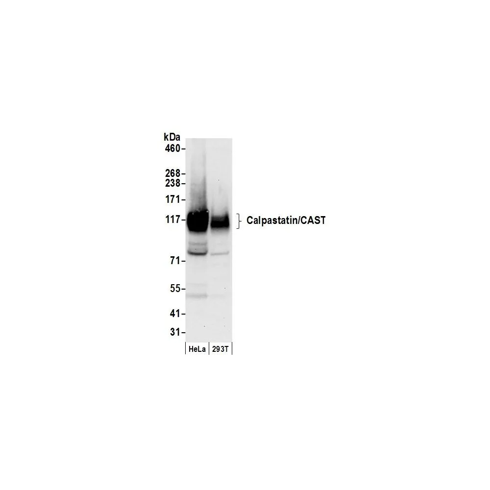 Rabbit anti-Calpastatin/CAST Antibody, Affinity Purified