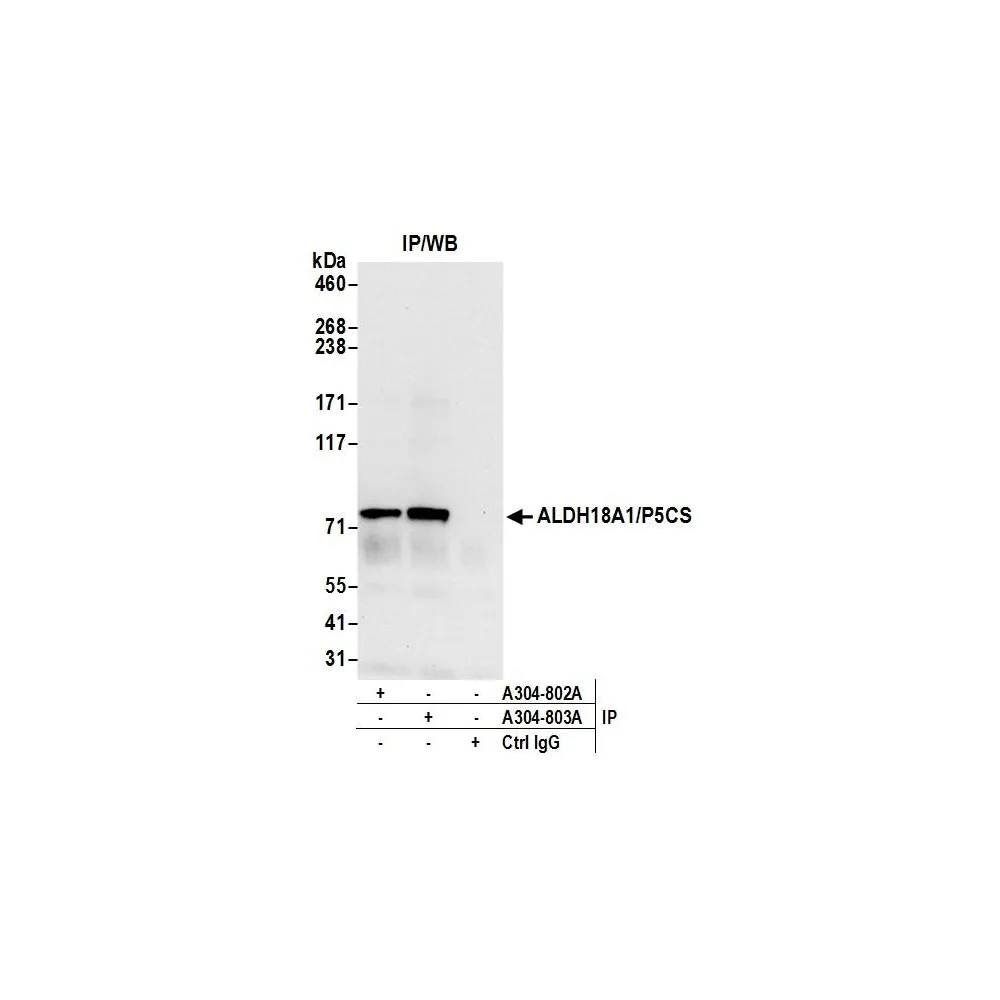 Rabbit anti-ALDH18A1/P5CS Antibody, Affinity Purified