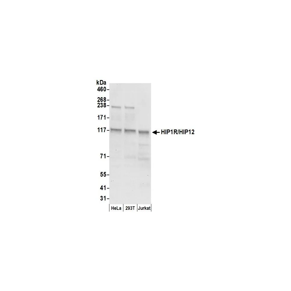 Rabbit anti-HIP1R/HIP12 Antibody, Affinity Purified