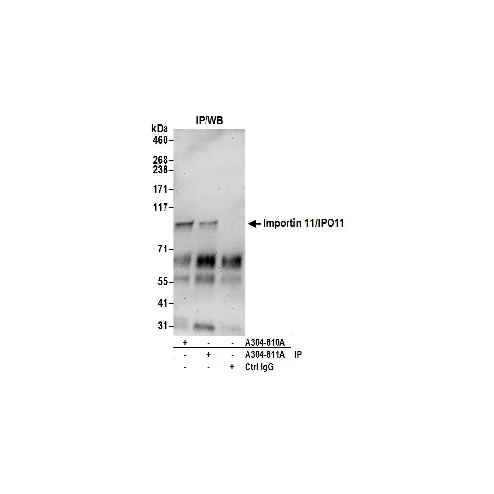 Rabbit anti-Importin 11/IPO11 Antibody, Affinity Purified
