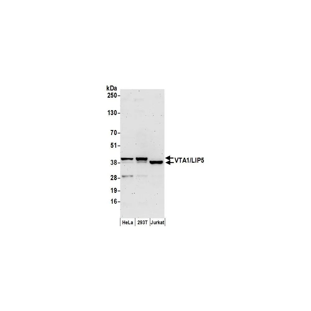 Rabbit anti-VTA1/LIP5 Antibody, Affinity Purified