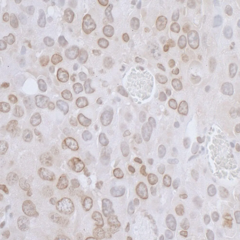 Rabbit anti-LAP2 beta/TMPO Antibody, Affinity Purified