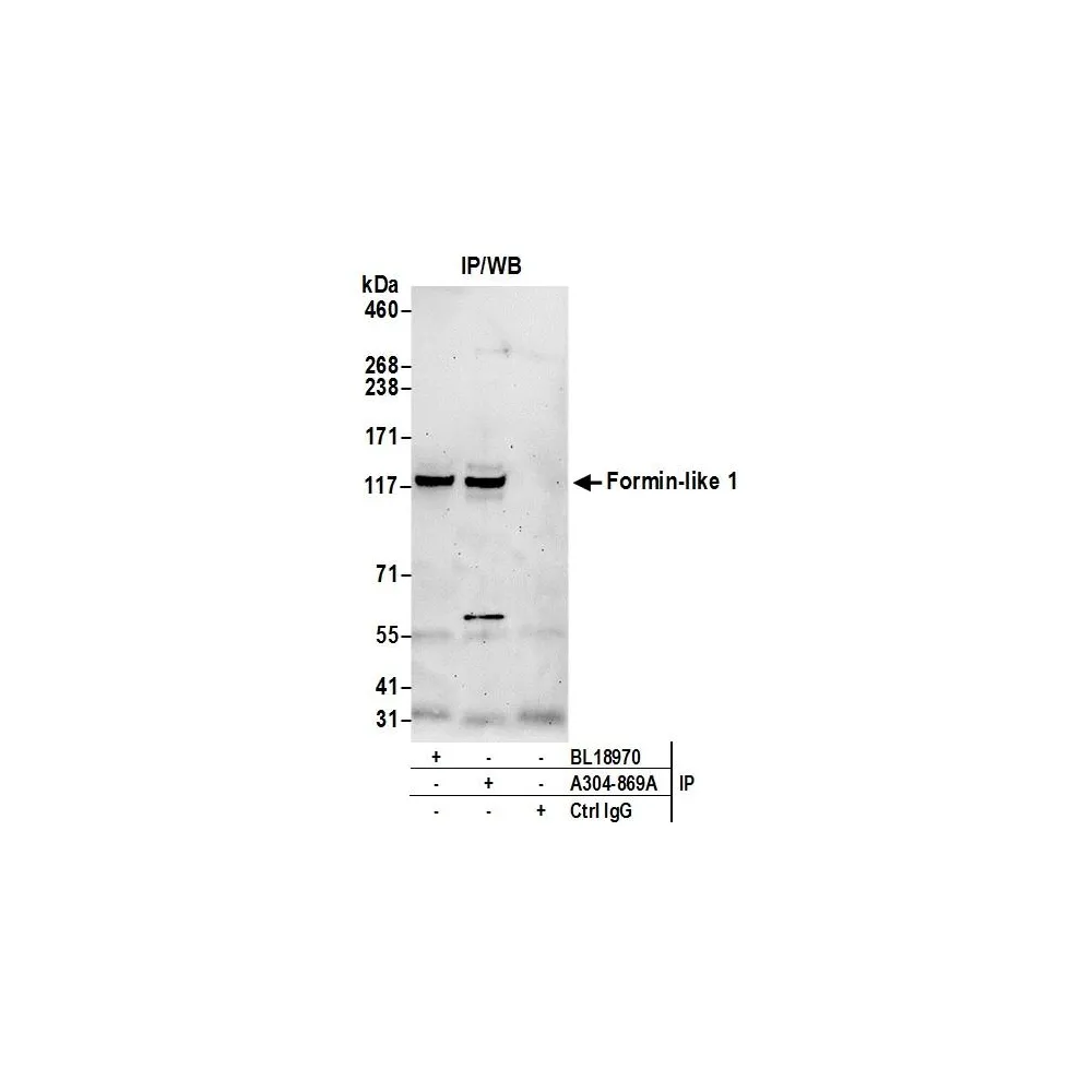 Rabbit anti-Formin-like 1/FMNL1 Antibody, Affinity Purified