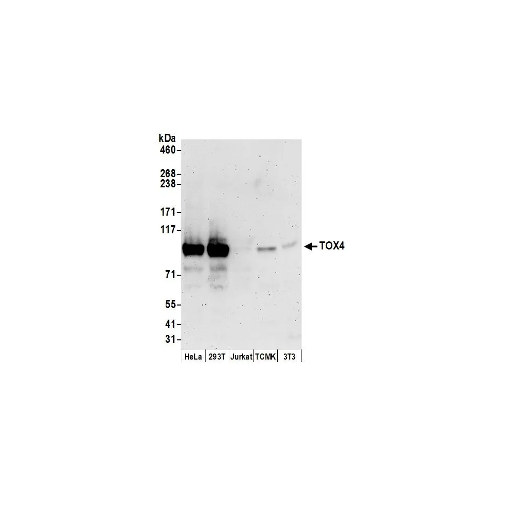 Rabbit anti-TOX4 Antibody, Affinity Purified