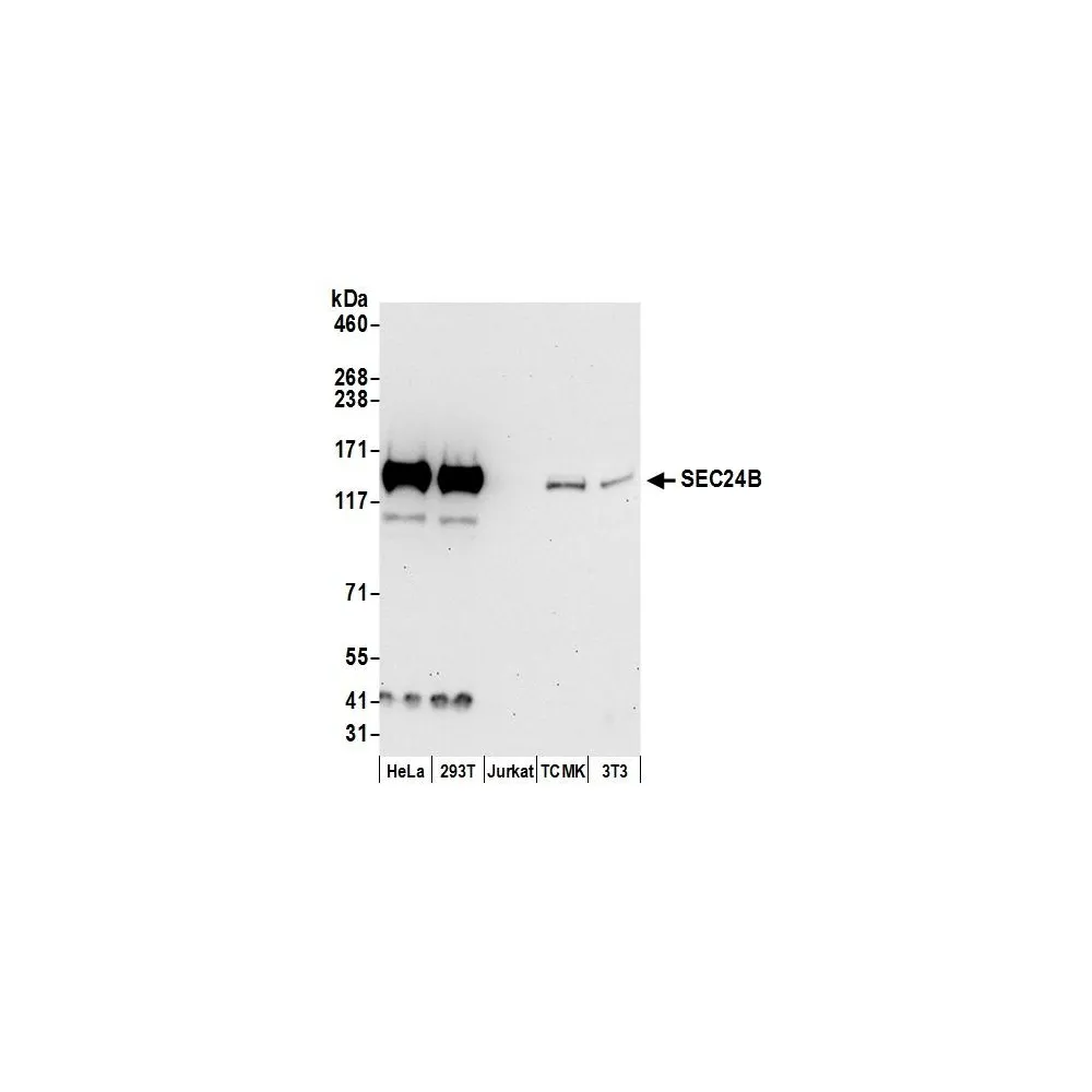 Rabbit anti-SEC24B Antibody, Affinity Purified