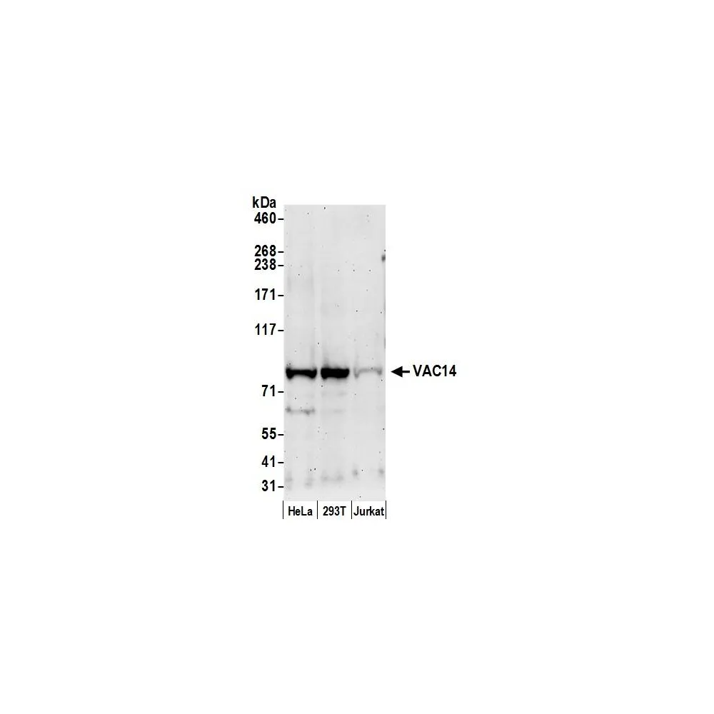 Rabbit anti-VAC14 Antibody, Affinity Purified