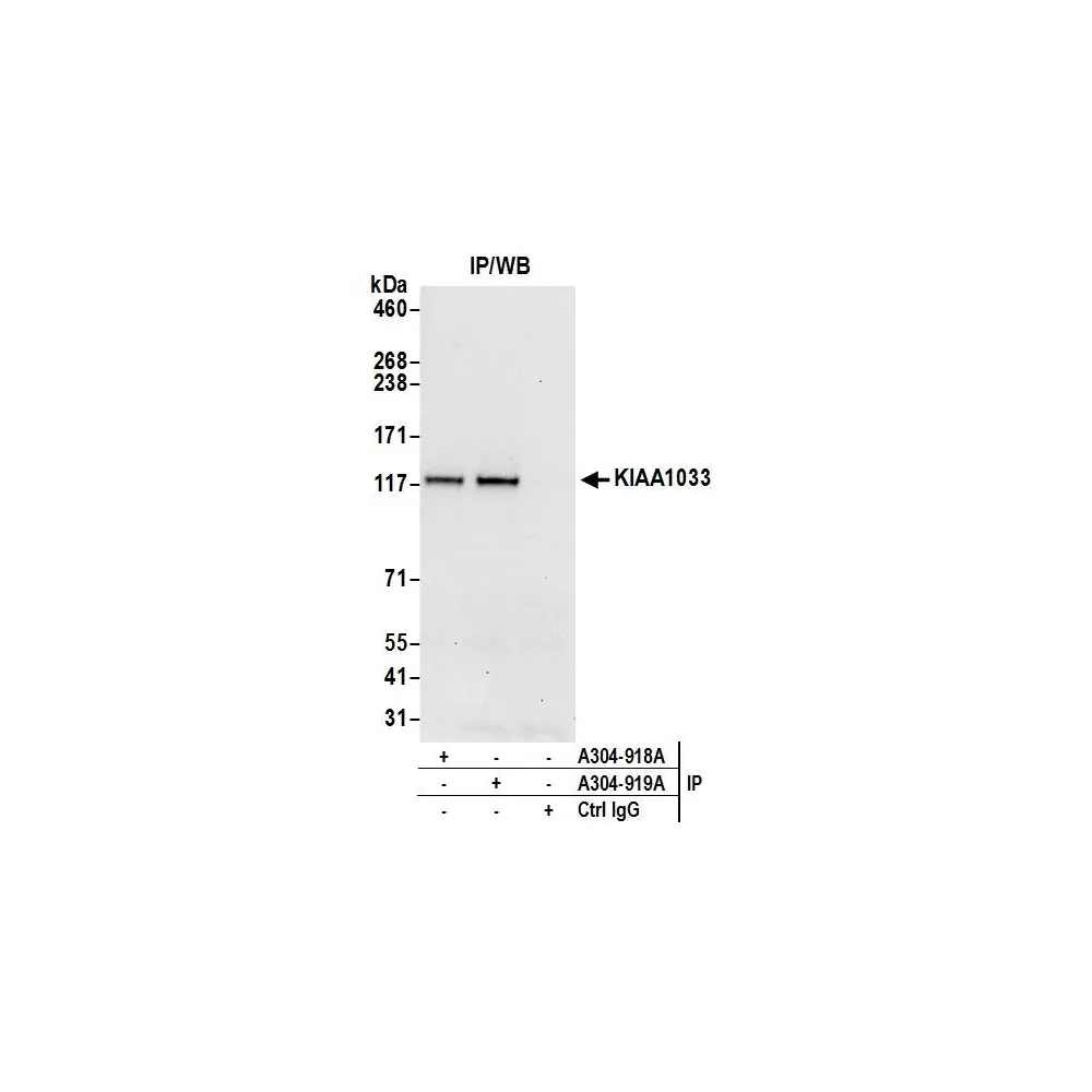 Rabbit anti-KIAA1033/WASH complex subunit 7 Antibody, Affinity Purified