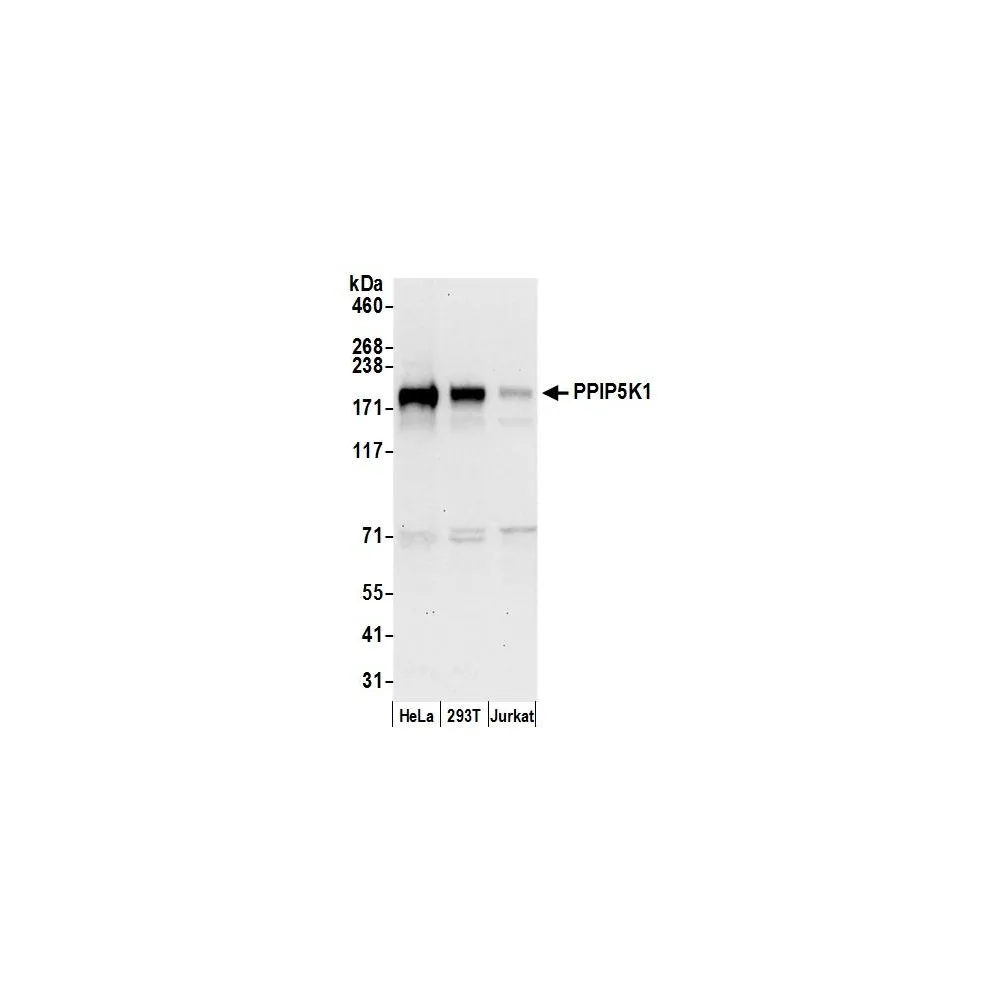 Rabbit anti-PPIP5K1/HISPPD2A Antibody, Affinity Purified