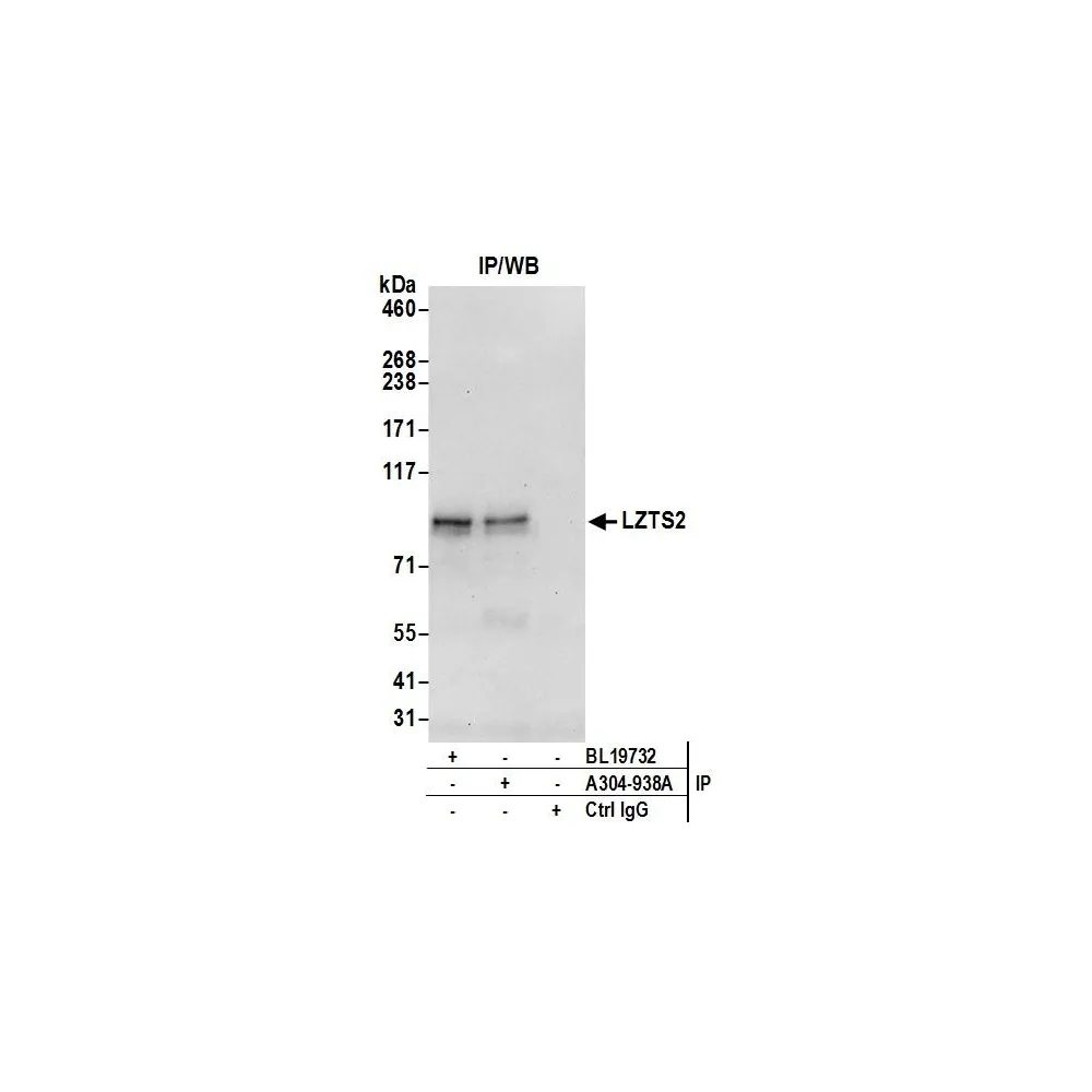 Rabbit anti-LZTS2 Antibody, Affinity Purified