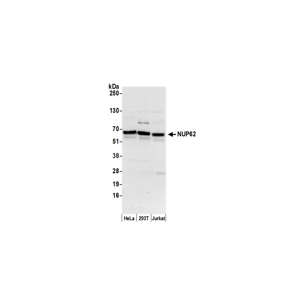 Rabbit anti-Nucleoporin p62/NUP62 Antibody, Affinity Purified