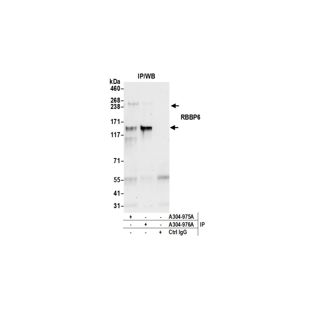 Rabbit anti-RBBP6 Antibody, Affinity Purified