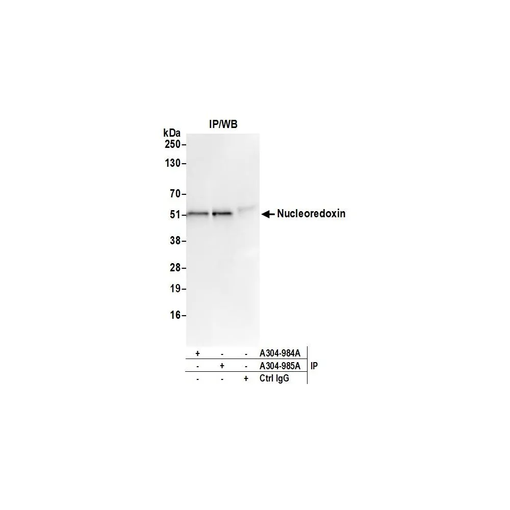 Rabbit anti-Nucleoredoxin/NXN Antibody, Affinity Purified